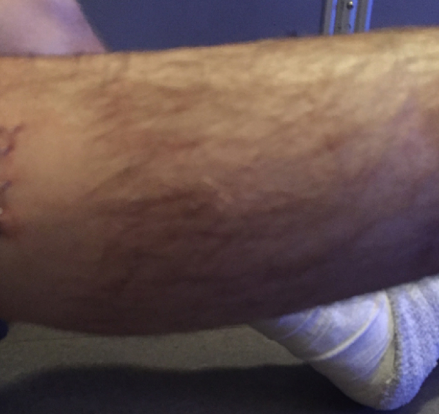 Matka chlapce pobodaného v parku: Ve Smetanových sadech se přepadá běžně, mám strach!